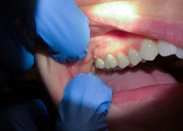Best Emergency Root Canal Therapy in Sonora, CA
